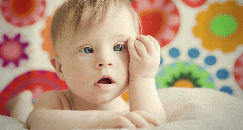 Down Sendromu Hakkında Bilinmesi Gerekenler